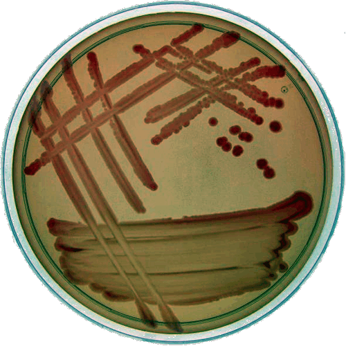 Escherichia Coli