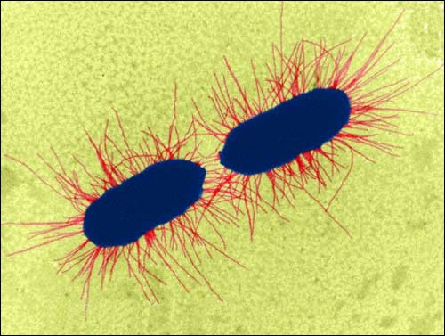 Escherichia Coli