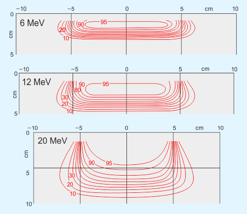 Hloubkové izodózy elektronů s energií 6 MeV, 12 Mev, 20 MeV