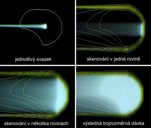 Princip aktivního skenování cílového objemu tužkovým protonovým svazkem