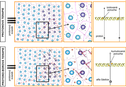 Srovnání klasické protonové terapie a protono-borové terapie