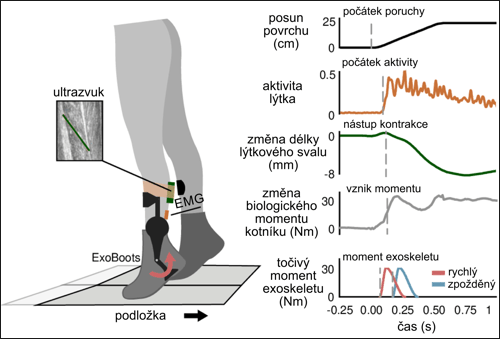 Poruchy rovnováhy a neuromechanická měření